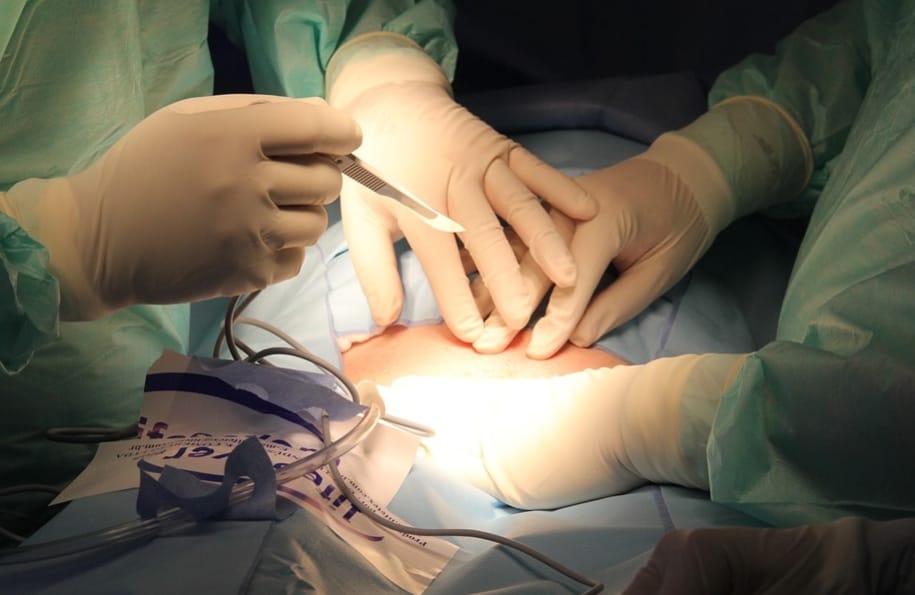 surgery operation